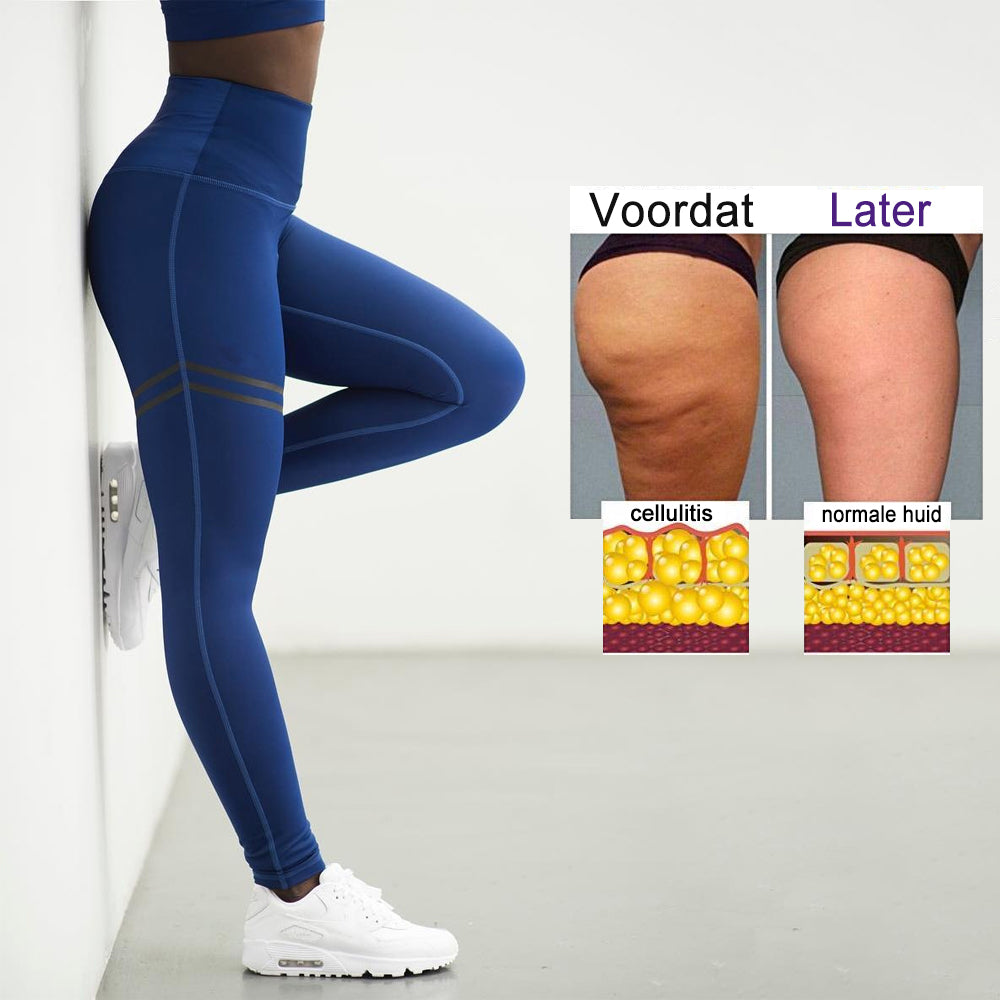 Anti-Cellulitis Compressielegging – Voor een Strakkere Huid en Slanker Silhouet - Andrea